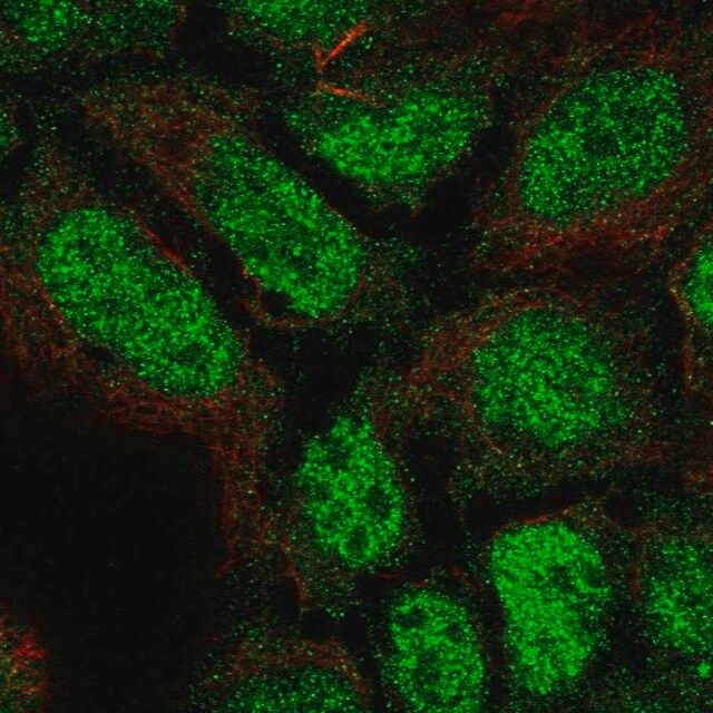 Anti-PLEKHG1 antibody produced in rabbit