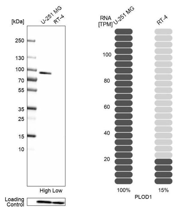 Anti-PLOD1 antibody produced in rabbit