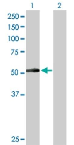 Anti-PNPLA3 antibody produced in rabbit