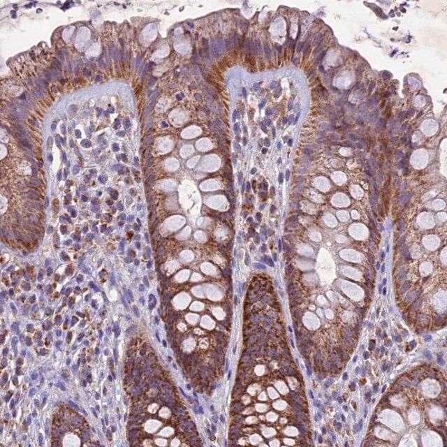 Anti-PMPCB antibody produced in rabbit