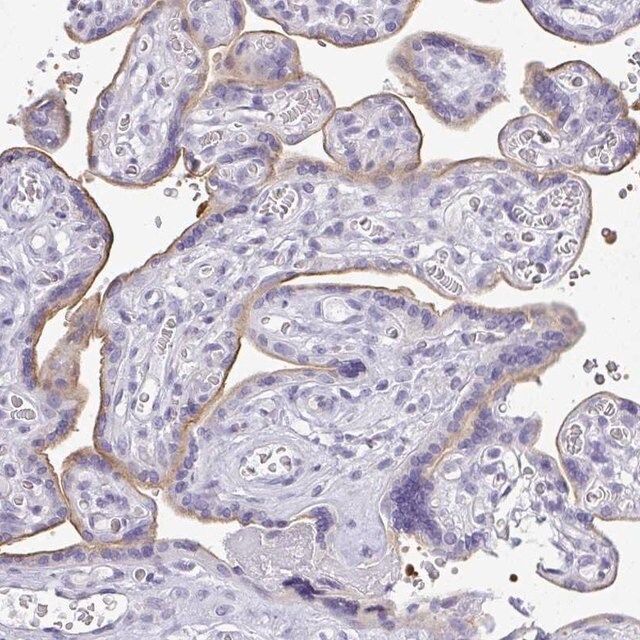 Anti-PLPPR3 antibody produced in rabbit