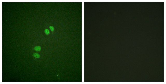 Anti-PLK1 antibody produced in rabbit