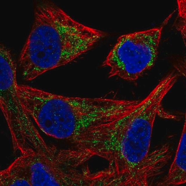 Anti-PMPCB antibody produced in rabbit