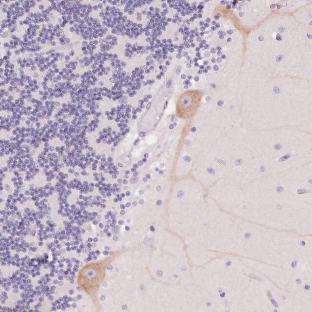 Anti-PNLIPRP3 antibody produced in rabbit