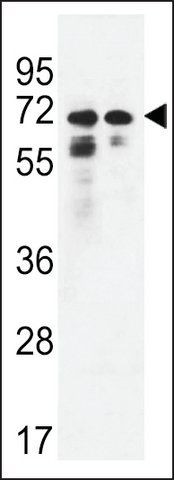 ANTI-PNPLA8(N-TERMINAL) antibody produced in rabbit