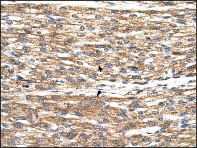 Anti-PNPLA3 antibody produced in rabbit