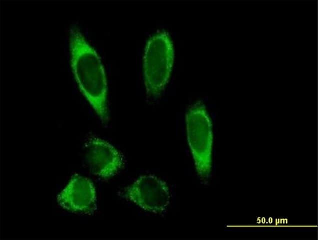 Anti-PLOD2 antibody produced in mouse