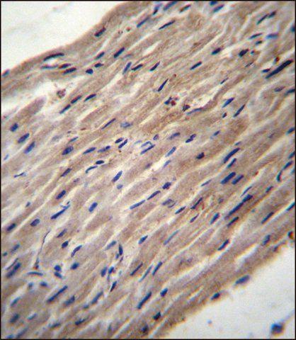 ANTI-PLOD1 (N-TERM) antibody produced in rabbit