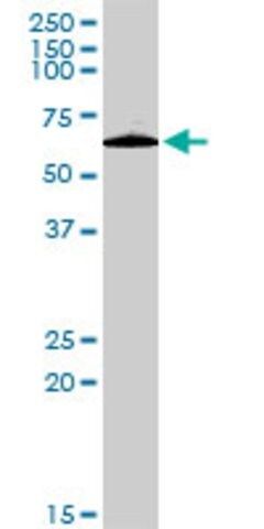 Anti-PLXDC1 antibody produced in rabbit