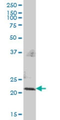 Anti-PMVK antibody produced in mouse