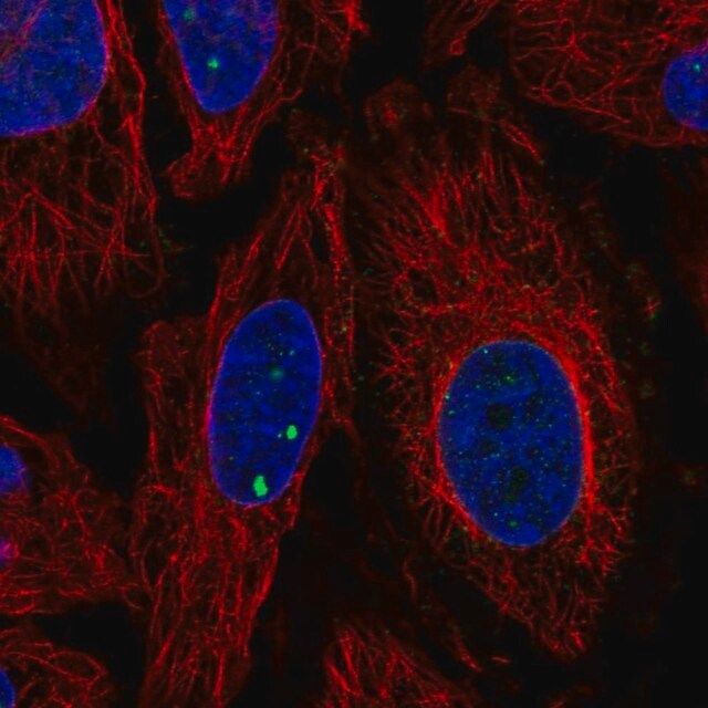 Anti-PLXDC2 antibody produced in rabbit