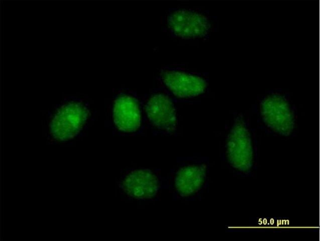 Anti-PLK1 antibody produced in mouse