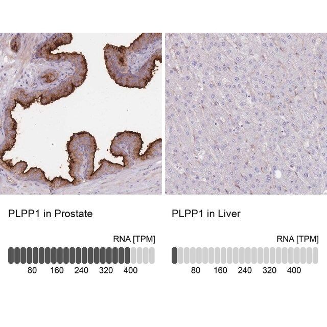 Anti-PLPP1 antibody produced in rabbit