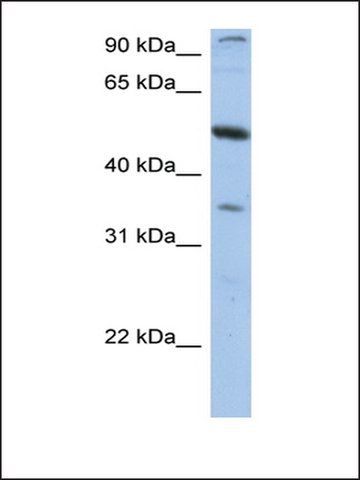 Anti-PLXDC1 antibody produced in rabbit