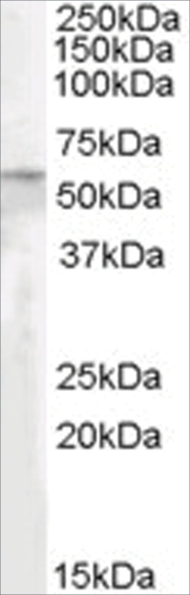 Anti-PNPLA2/ATGL antibody produced in goat