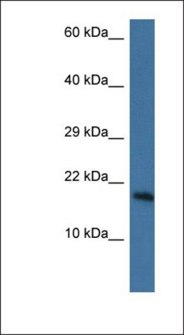 Anti-PNKD antibody produced in rabbit