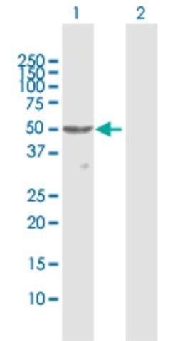 Anti-PNLIPRP1 antibody produced in rabbit