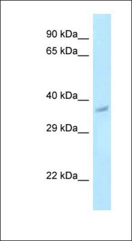 Anti-PNCK antibody produced in rabbit