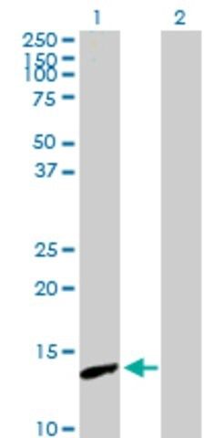 Anti-PNCK antibody produced in mouse