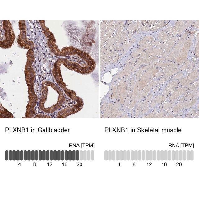 Anti-PLXNB1 antibody produced in rabbit