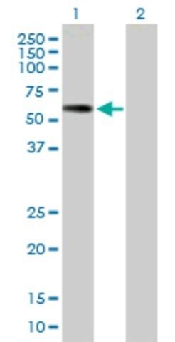 Anti-PNLIPRP2 antibody produced in mouse