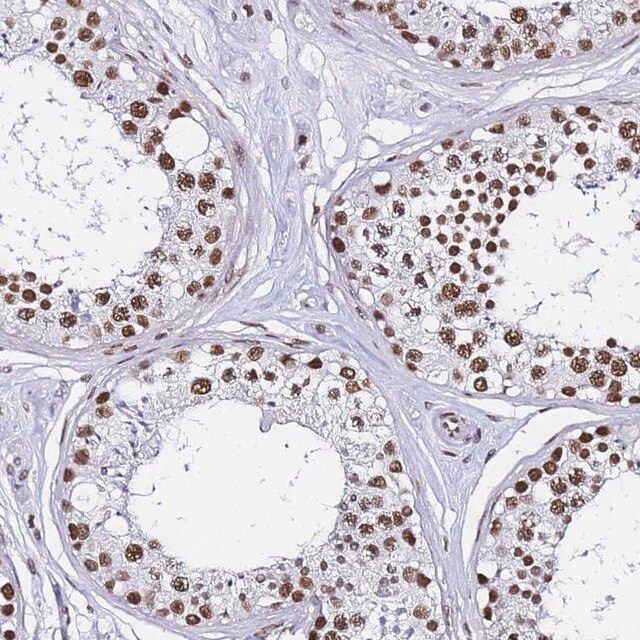 Anti-POLR1A antibody produced in rabbit