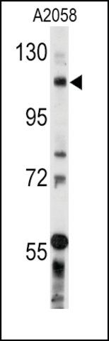 Anti-POLD1 (N-term) antibody produced in rabbit