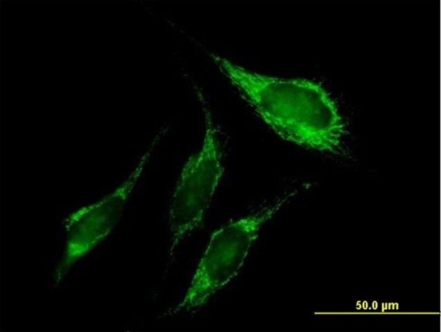 Anti-PNPT1 antibody produced in mouse