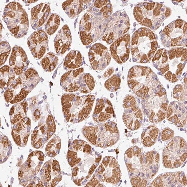 Anti-PNPLA5 antibody produced in rabbit