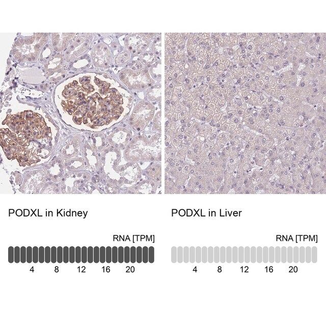 Anti-PODXL antibody produced in rabbit