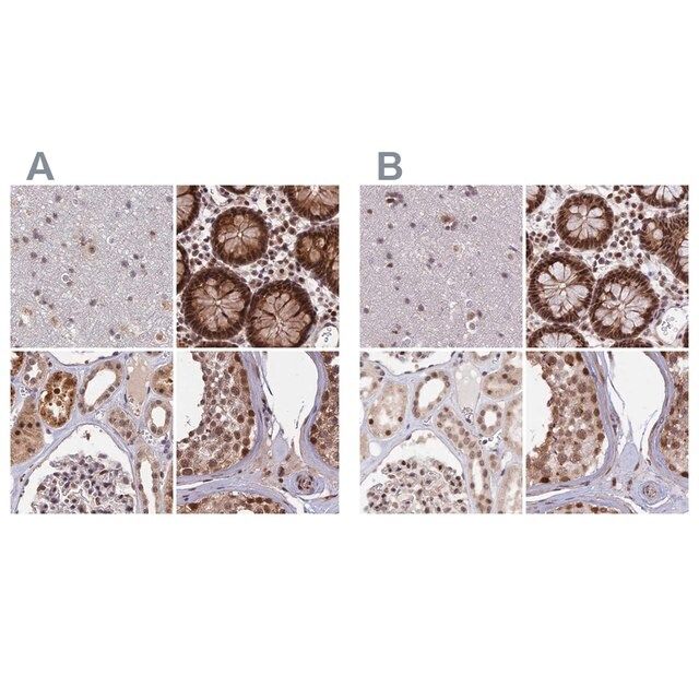 Anti-POLR2C antibody produced in rabbit