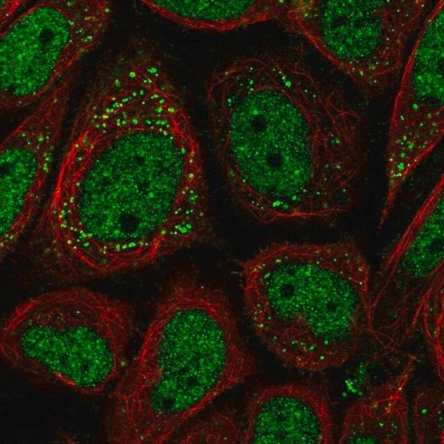 Anti-PNPLA2 antibody produced in rabbit