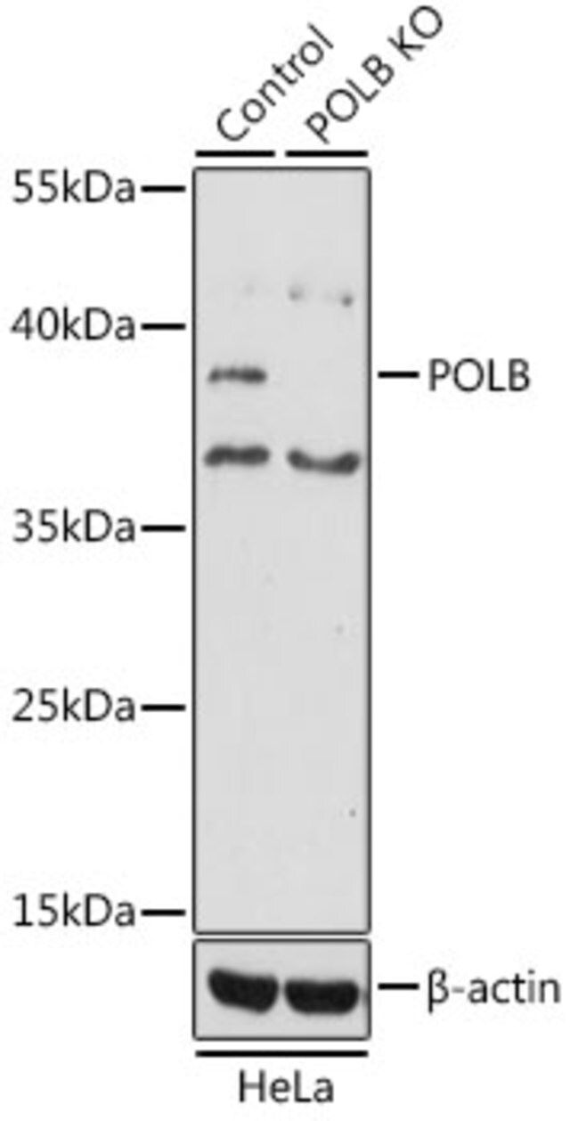 Anti-POLB antibody produced in rabbit