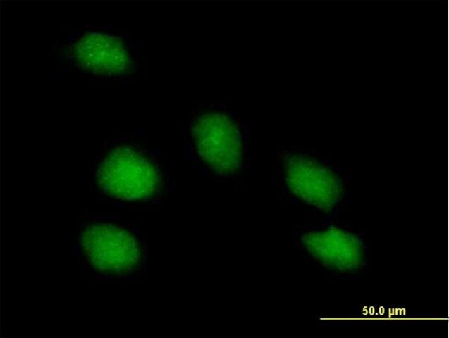 Anti-PNMA1 antibody produced in mouse