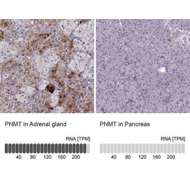 Anti-PNMT antibody produced in rabbit