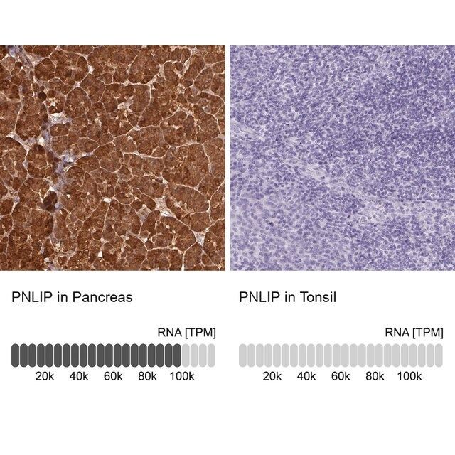 Anti-PNLIP antibody produced in rabbit