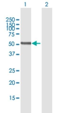 Anti-PNPLA3 antibody produced in mouse