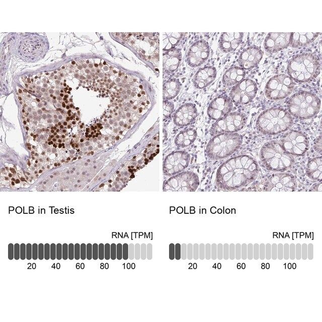 Anti-POLB antibody produced in rabbit