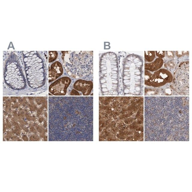 Anti-PNPO antibody produced in rabbit