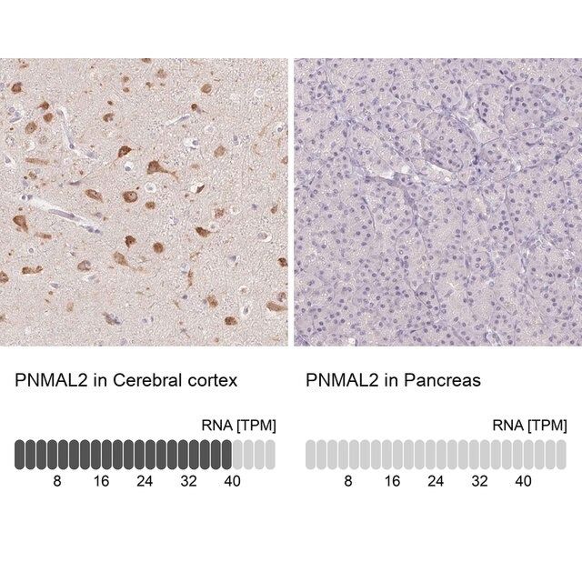 Anti-PNMAL2 antibody produced in rabbit