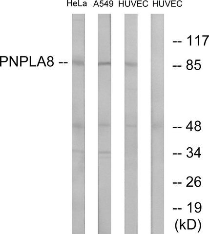 Anti-PNPLA8 antibody produced in rabbit