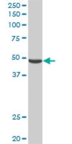 Anti-PNLIPRP2 antibody produced in rabbit