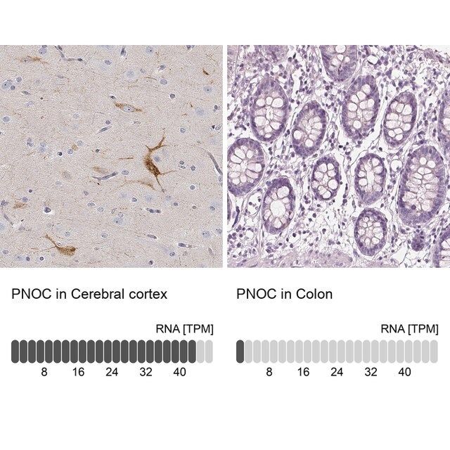 Anti-PNOC antibody produced in rabbit