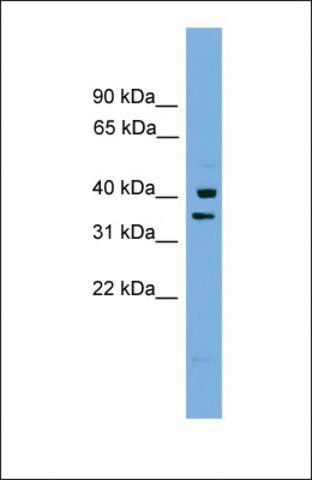 Anti-PNRC1 antibody produced in rabbit