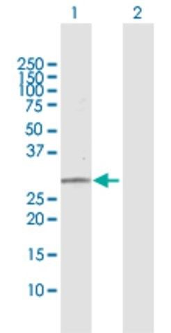 Anti-PNPO antibody produced in rabbit