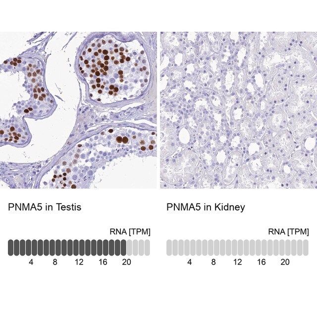 Anti-PNMA5 antibody produced in rabbit