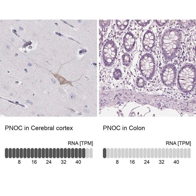 Anti-PNOC antibody produced in rabbit