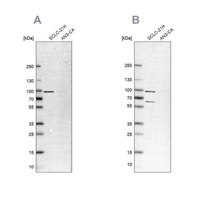 Anti-PNPT1 antibody produced in rabbit