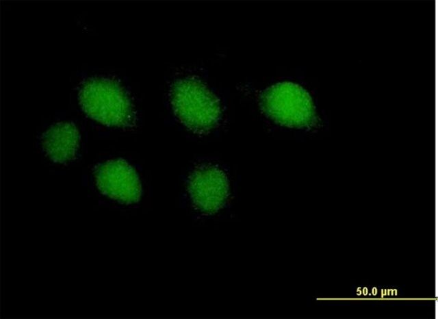 Anti-POLE antibody produced in mouse