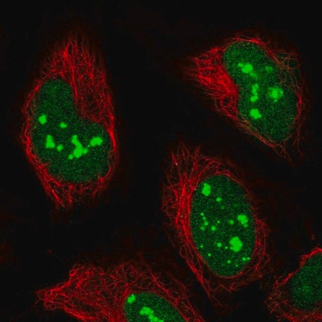 Anti-POLR1E antibody produced in rabbit